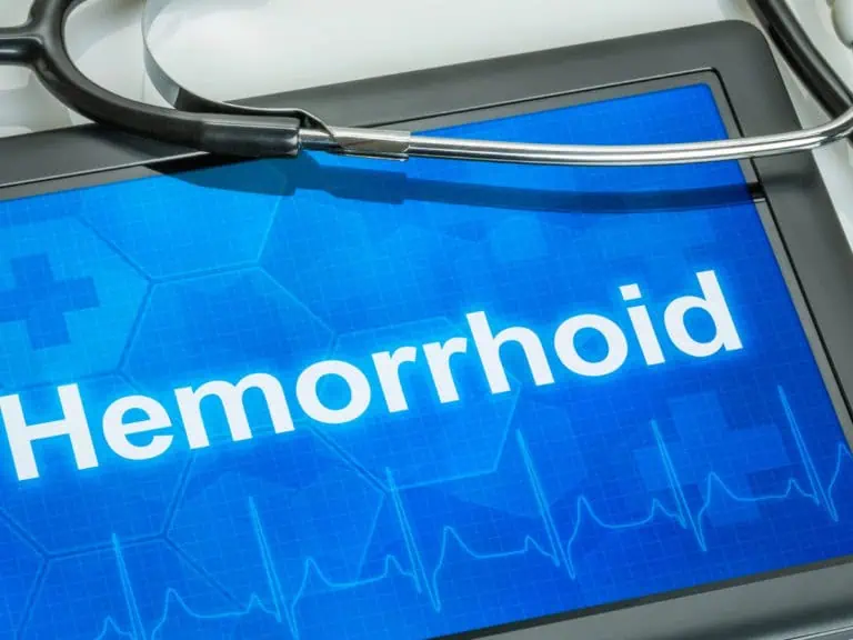 обостряне на хемороиди