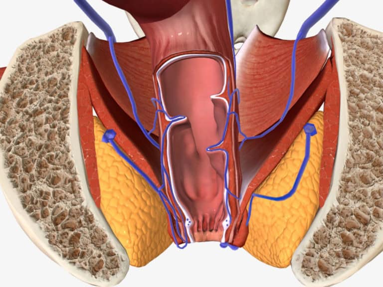 вътрешни хемоороиди